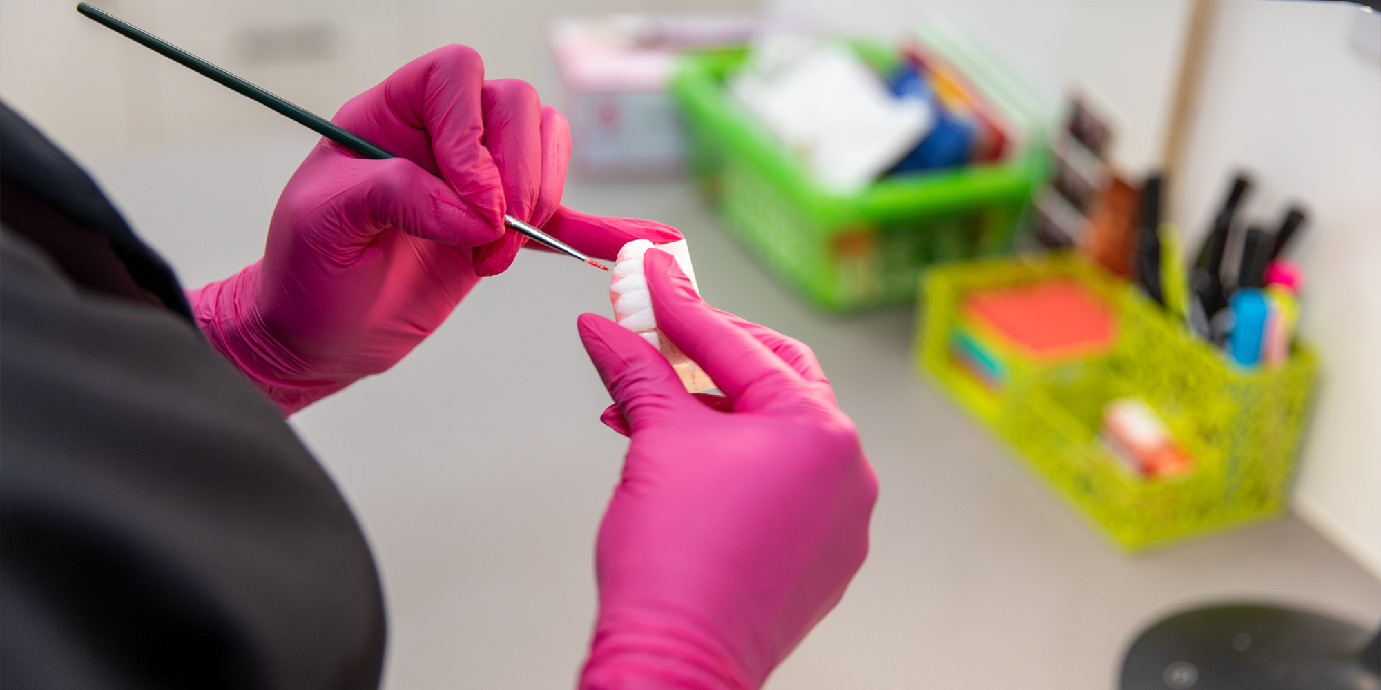 same day dental implants chino hills